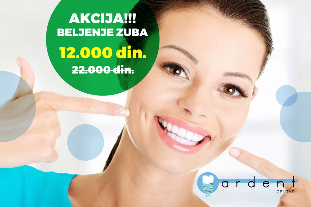AKCIJA – Beljenje zuba i do 45% niže cene!